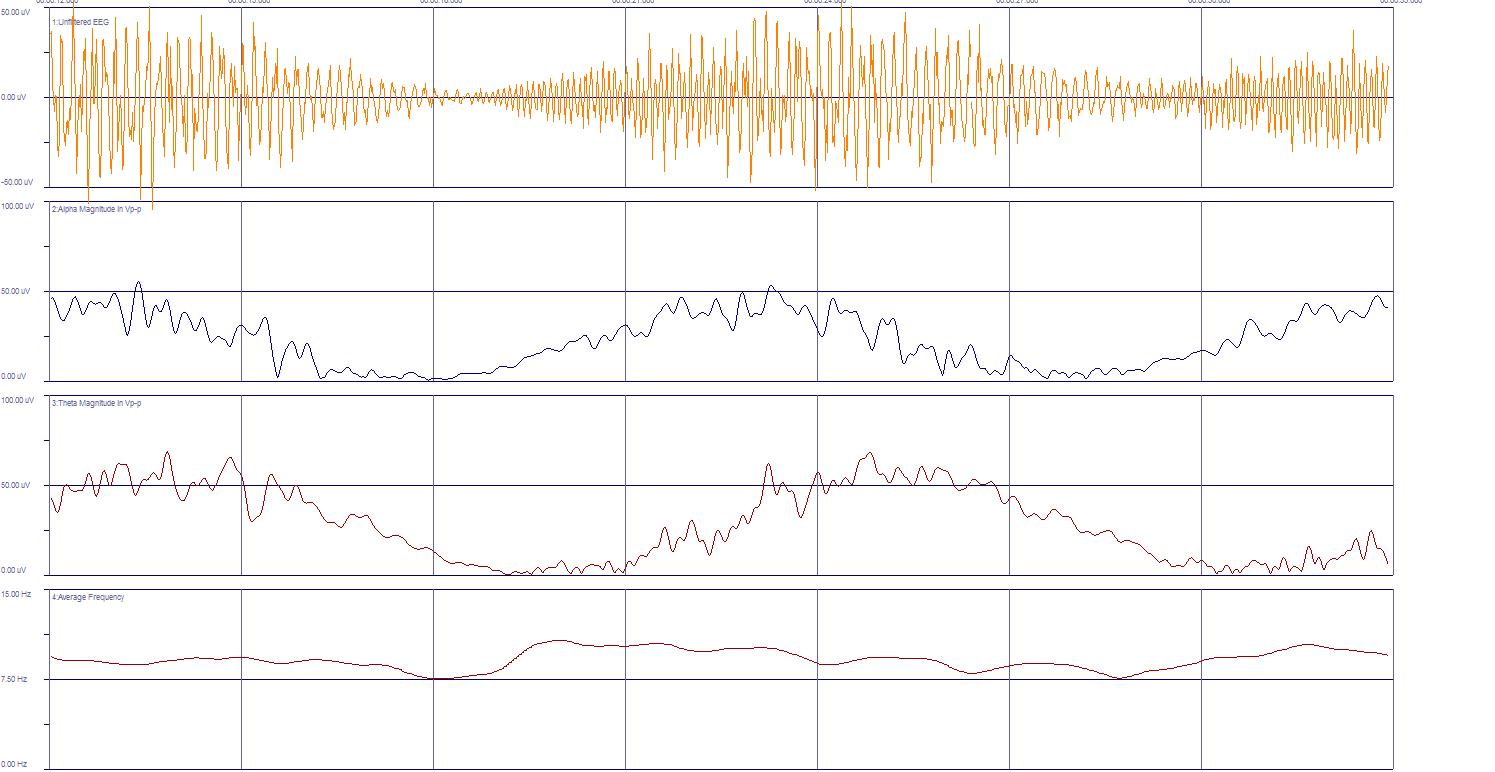 neuromarketing_slider_eeg2